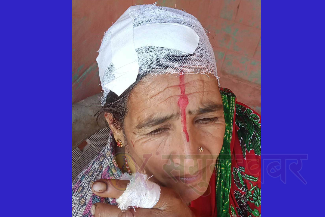 बैतडीमा बाँदरको आक्रमणबाट एक महिला घाइते 